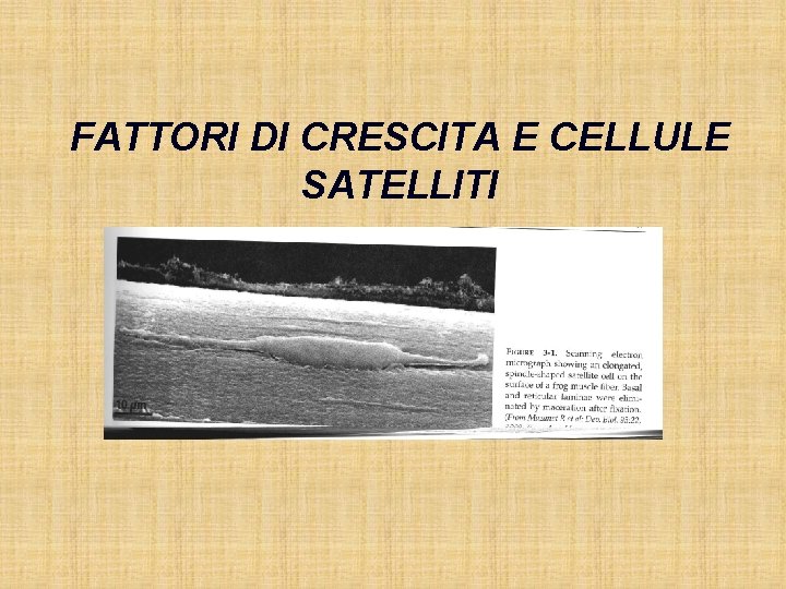 FATTORI DI CRESCITA E CELLULE SATELLITI 