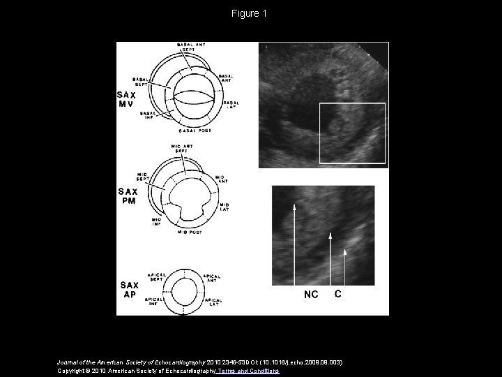 Figure 1 Journal of the American Society of Echocardiography 2010 2346 -53 DOI: (10.