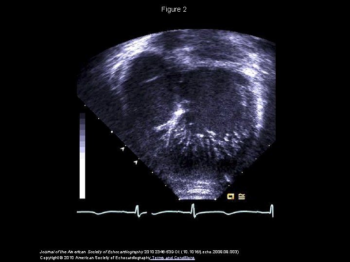 Figure 2 Journal of the American Society of Echocardiography 2010 2346 -53 DOI: (10.