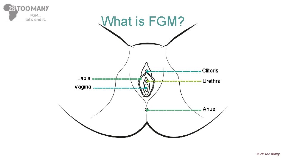 What is FGM? Clitoris Labia Vagina Urethra Anus © 28 Too Many 
