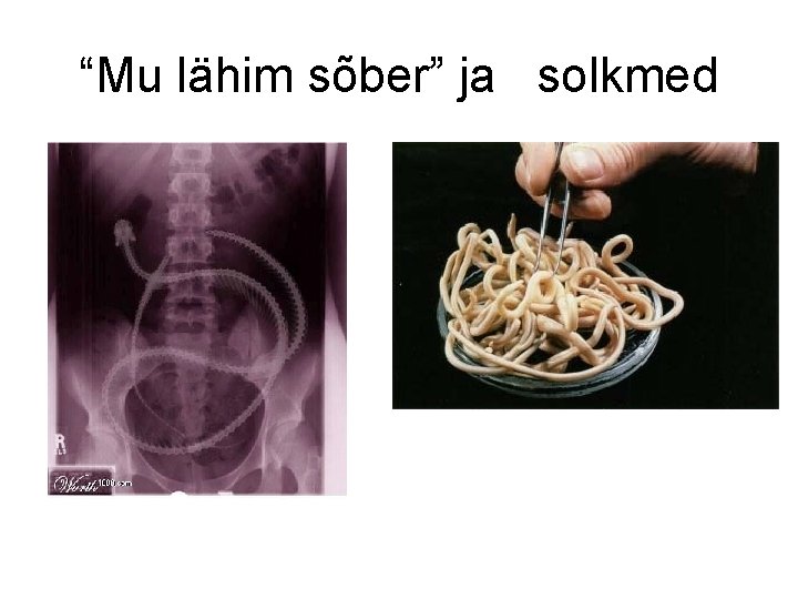 “Mu lähim sõber” ja solkmed 