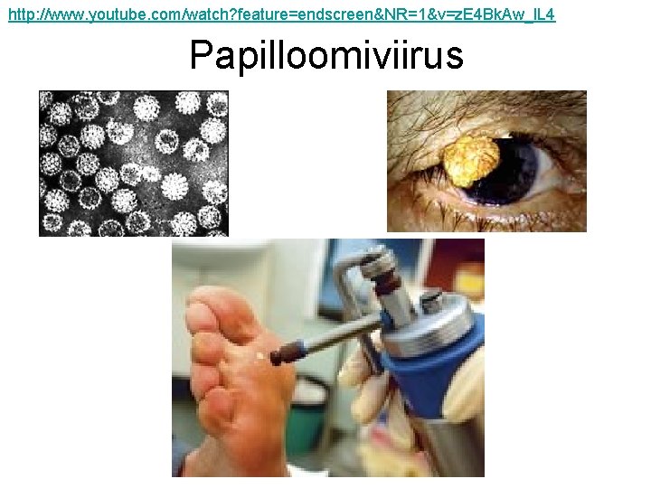 http: //www. youtube. com/watch? feature=endscreen&NR=1&v=z. E 4 Bk. Aw_l. L 4 Papilloomiviirus 