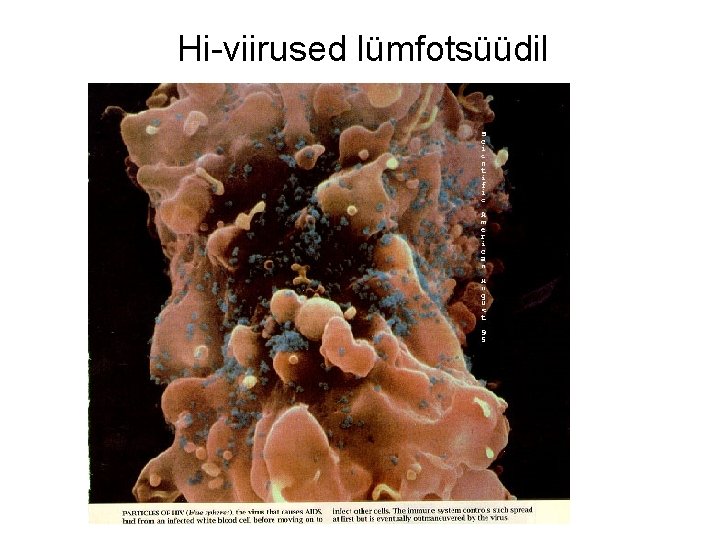 Hi-viirused lümfotsüüdil 