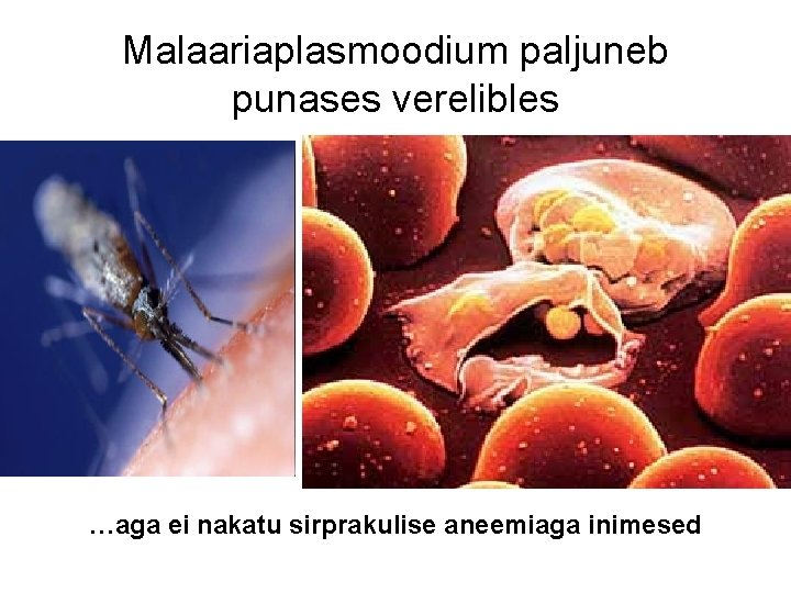 Malaariaplasmoodium paljuneb punases verelibles …aga ei nakatu sirprakulise aneemiaga inimesed 