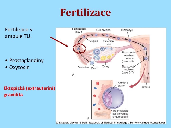 Fertilizace v ampule TU. • Prostaglandiny • Oxytocin Ektopická (extrauteriní) gravidita 
