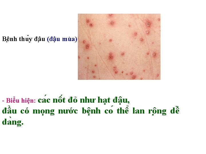 Kim Tra Bi C Cu 1 Tri Nh