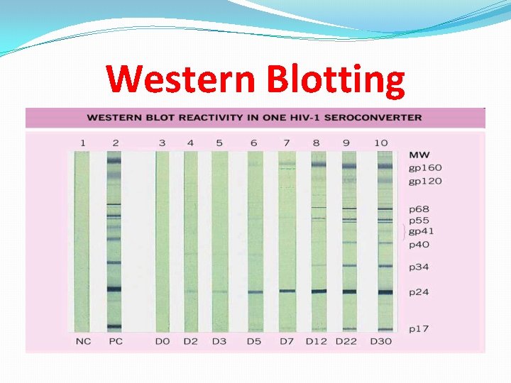 Western Blotting 