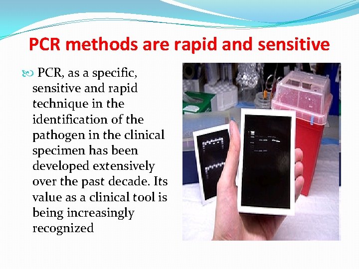 PCR methods are rapid and sensitive PCR, as a specific, sensitive and rapid technique