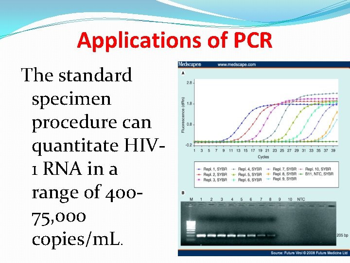 Applications of PCR The standard specimen procedure can quantitate HIV 1 RNA in a