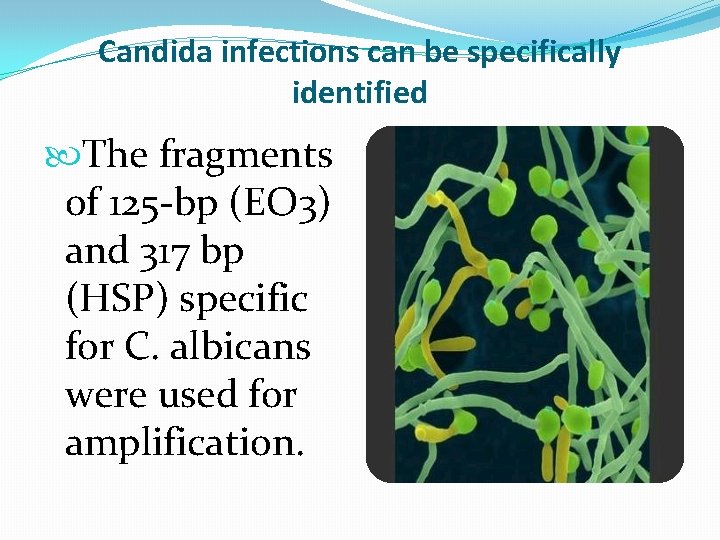 Candida infections can be specifically identified The fragments of 125 -bp (EO 3) and