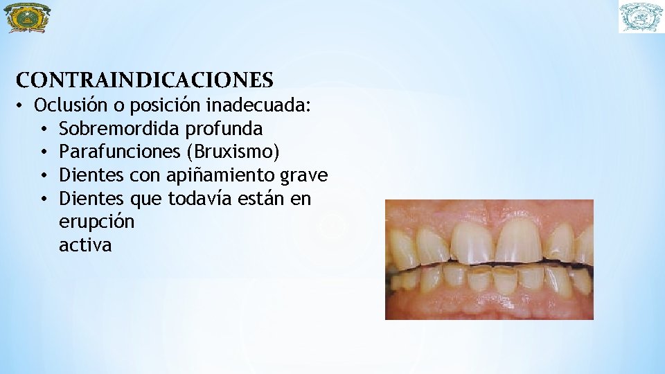 CONTRAINDICACIONES • Oclusión o posición inadecuada: • Sobremordida profunda • Parafunciones (Bruxismo) • Dientes