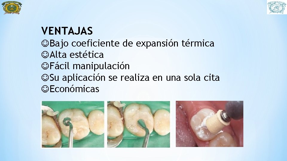 VENTAJAS JBajo coeficiente de expansión térmica JAlta estética JFácil manipulación JSu aplicación se realiza