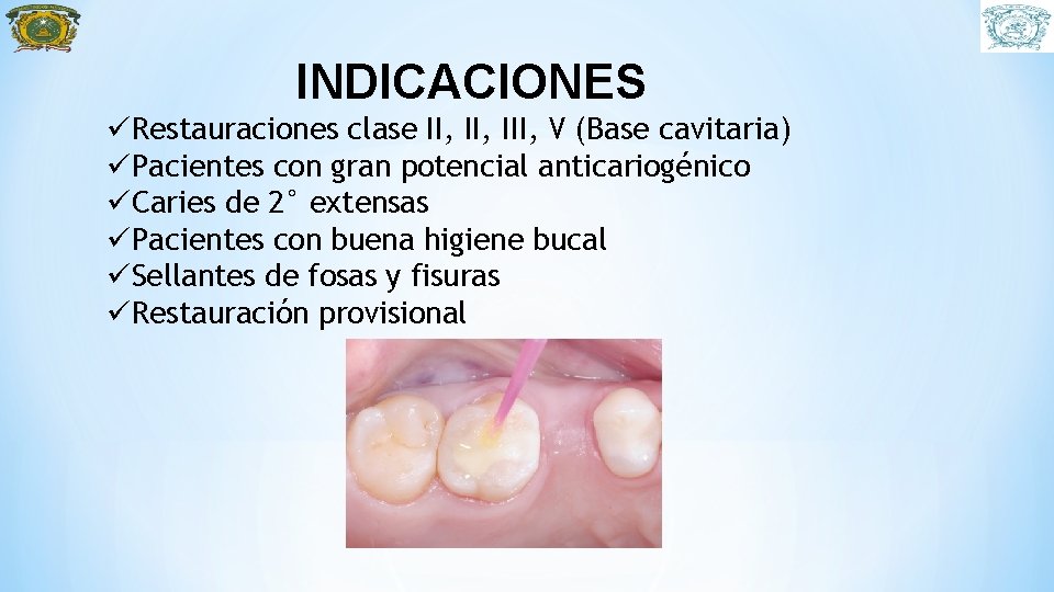 INDICACIONES üRestauraciones clase II, III, V (Base cavitaria) üPacientes con gran potencial anticariogénico üCaries