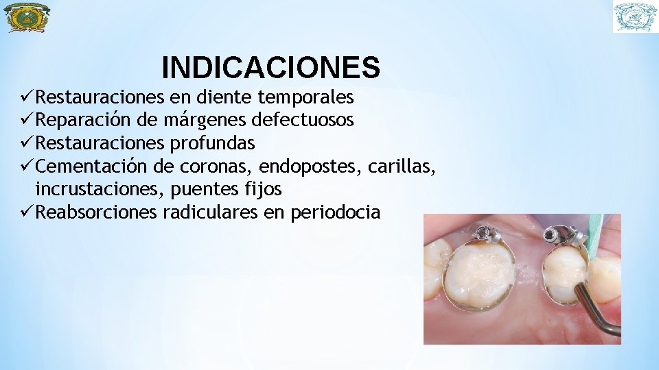 INDICACIONES üRestauraciones en diente temporales üReparación de márgenes defectuosos üRestauraciones profundas üCementación de coronas,