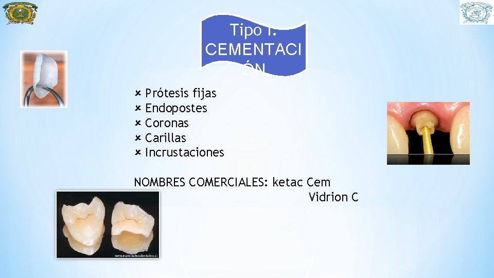 Tipo I: CEMENTACI ÓN Prótesis fijas Endopostes Coronas Carillas Incrustaciones NOMBRES COMERCIALES: ketac Cem