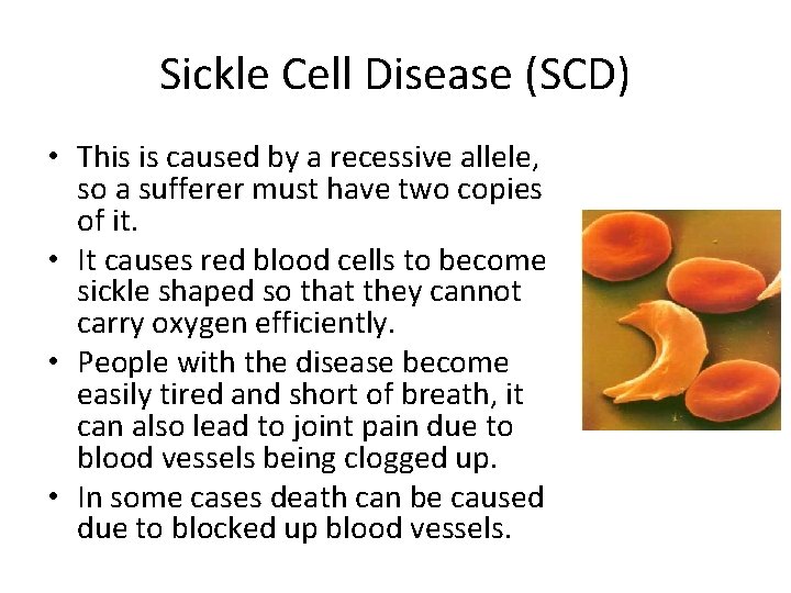 Sickle Cell Disease (SCD) • This is caused by a recessive allele, so a