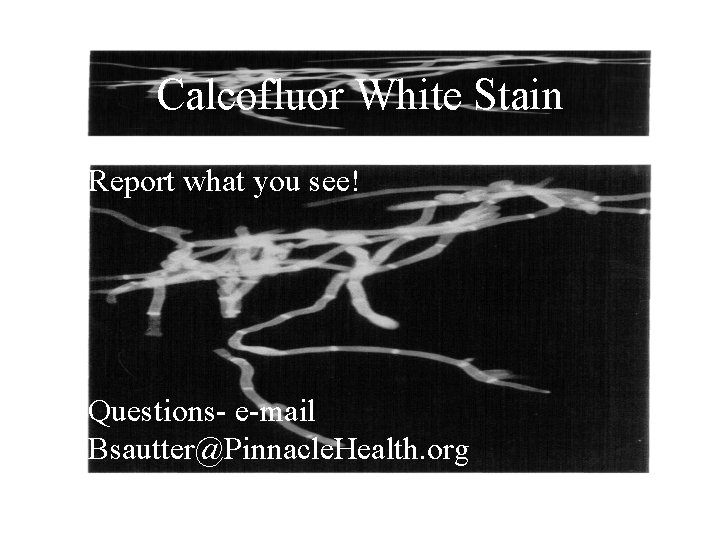 Calcofluor White Stain • Report what you see! • Questions- e-mail Bsautter@Pinnacle. Health. org