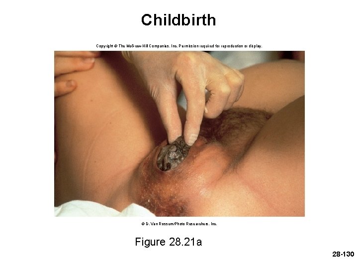 Childbirth Copyright © The Mc. Graw-Hill Companies, Inc. Permission required for reproduction or display.