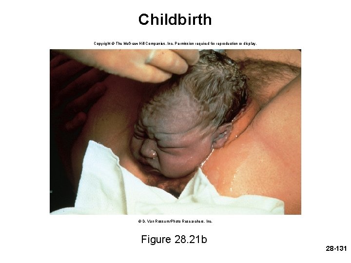 Childbirth Copyright © The Mc. Graw-Hill Companies, Inc. Permission required for reproduction or display.