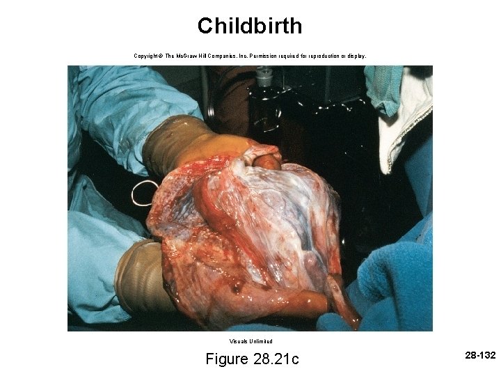 Childbirth Copyright © The Mc. Graw-Hill Companies, Inc. Permission required for reproduction or display.