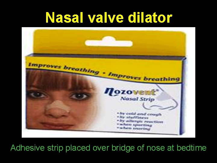 Nasal valve dilator Adhesive strip placed over bridge of nose at bedtime 