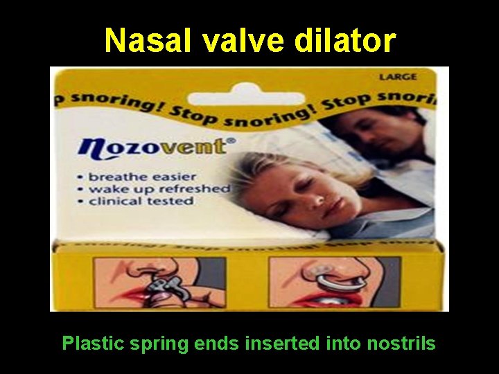 Nasal valve dilator Plastic spring ends inserted into nostrils 