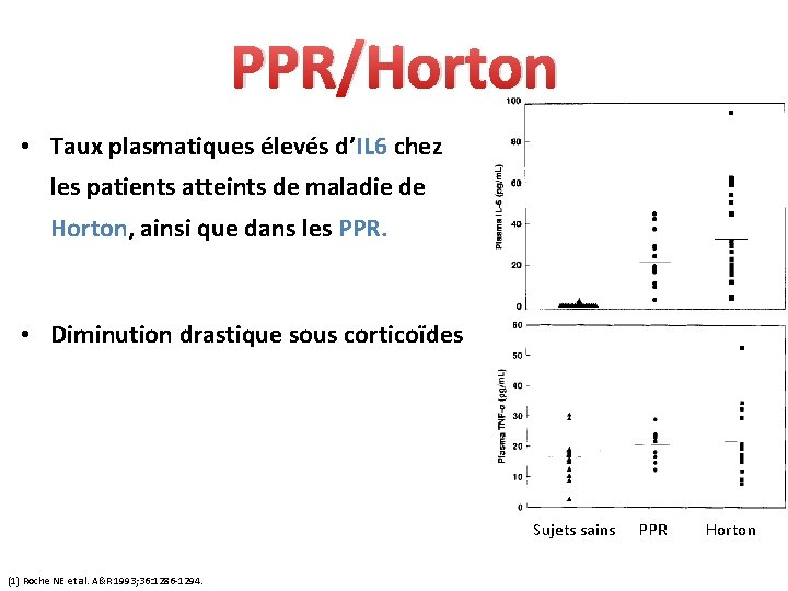 PPR/Horton • Taux plasmatiques élevés d’IL 6 chez les patients atteints de maladie de