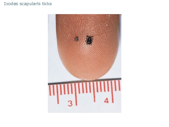 Ixodes scapularis ticks 