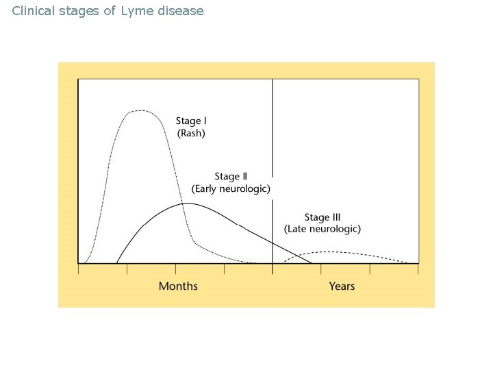 Clinical stages of Lyme disease 