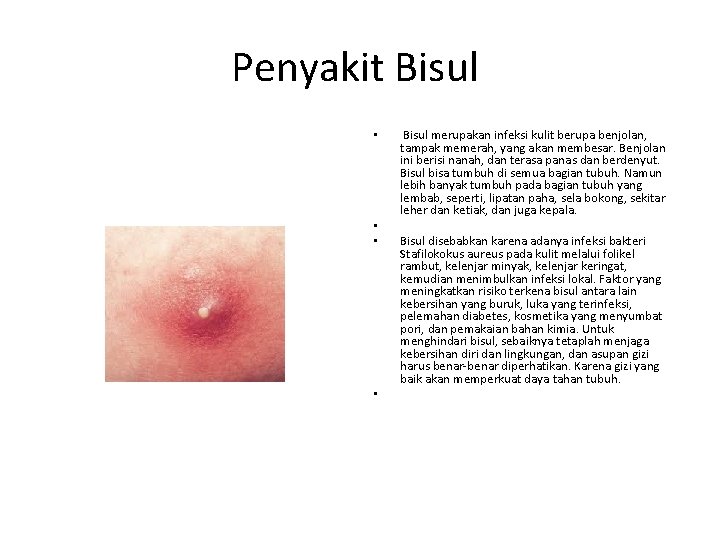 Penyakit Bisul • • Bisul merupakan infeksi kulit berupa benjolan, tampak memerah, yang akan