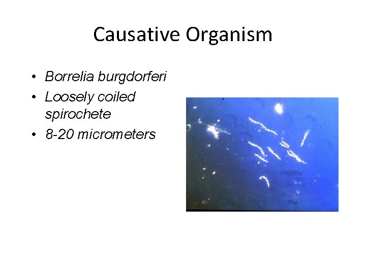 Causative Organism • Borrelia burgdorferi • Loosely coiled spirochete • 8 -20 micrometers 