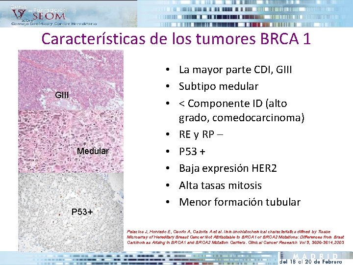 Características de los tumores BRCA 1 GIII Medular P 53+ • La mayor parte