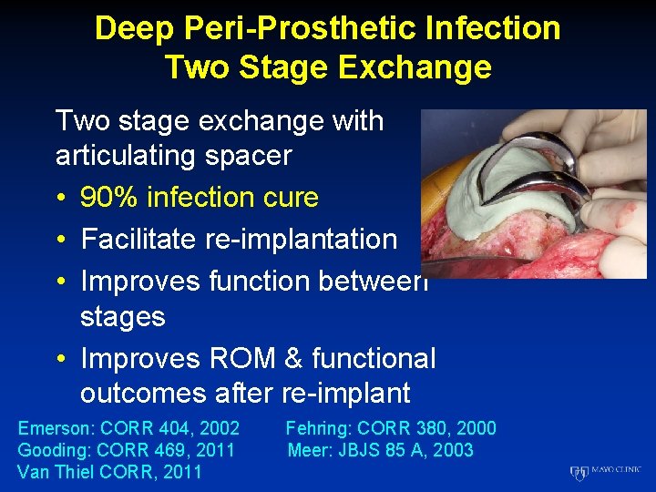 Deep Peri-Prosthetic Infection Two Stage Exchange Two stage exchange with articulating spacer • 90%