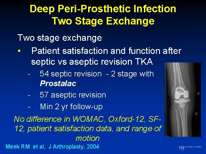 Deep Peri-Prosthetic Infection Two Stage Exchange Two stage exchange • Patient satisfaction and function