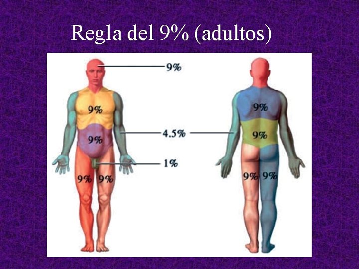 Regla del 9% (adultos) 