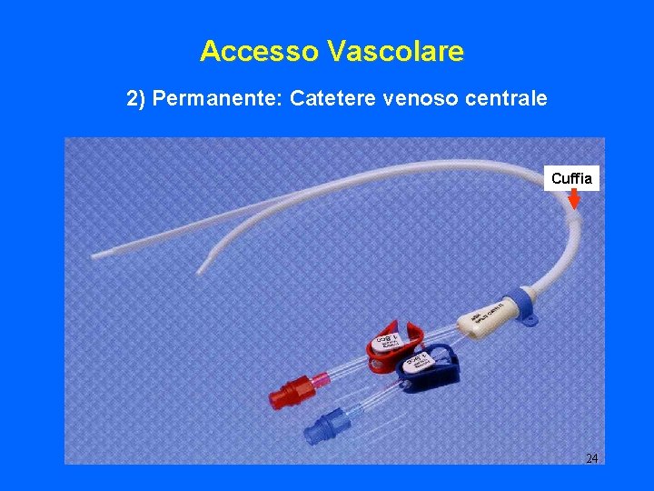 Accesso Vascolare 2) Permanente: Catetere venoso centrale Cuffia 24 