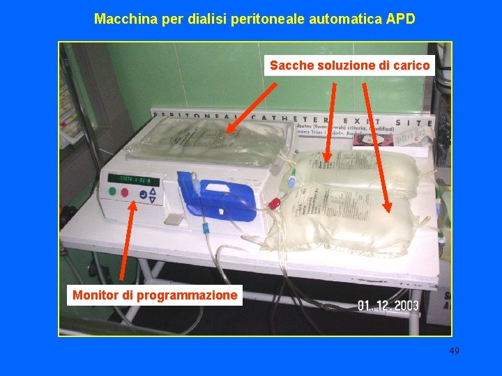 Macchina per dialisi peritoneale automatica APD Sacche soluzione di carico Monitor di programmazione 49