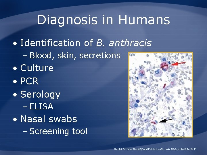 Diagnosis in Humans • Identification of B. anthracis – Blood, skin, secretions • Culture