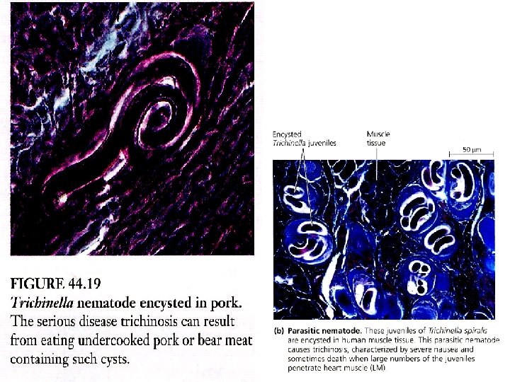 Nematoda : Trichinella sp. 20 nematodes and annelides 
