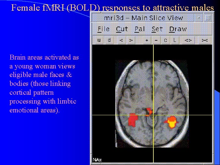Female f. MRI (BOLD) responses to attractive males Brain areas activated as a young