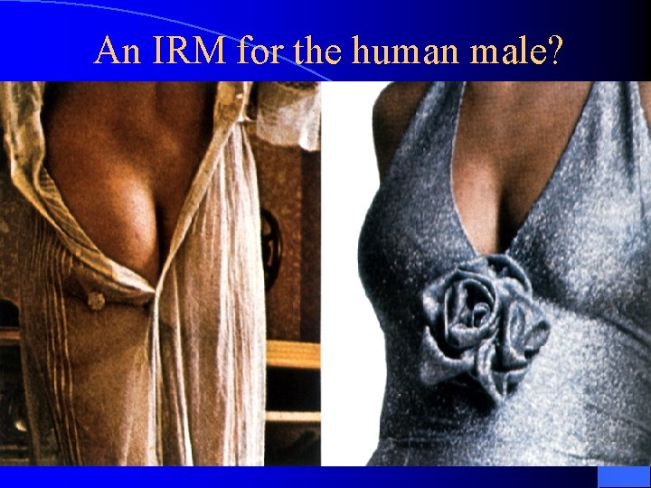 An IRM for the human male? 