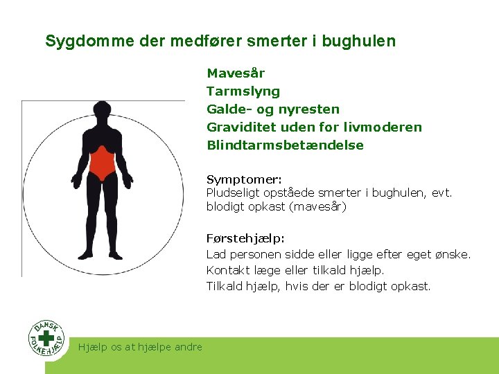 Sygdomme der medfører smerter i bughulen Mavesår Tarmslyng Galde- og nyresten Graviditet uden for Sygdomme der medfører smerter i bughulen Mavesår Tarmslyng Galde- og nyresten Graviditet uden for