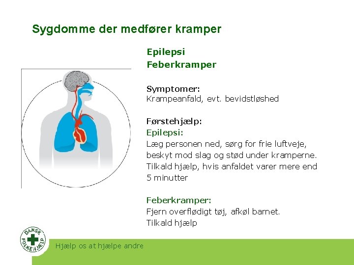 Sygdomme der medfører kramper Epilepsi Feberkramper Symptomer: Krampeanfald, evt. bevidstløshed Førstehjælp: Epilepsi: Læg personen Sygdomme der medfører kramper Epilepsi Feberkramper Symptomer: Krampeanfald, evt. bevidstløshed Førstehjælp: Epilepsi: Læg personen