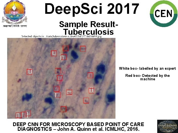 Deep. Sci 2017 Sample Result. Tuberculosis White box- labelled by an expert Red box-