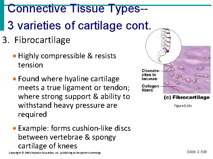 Connective Tissue Types-3 varieties of cartilage cont. 3. Fibrocartilage · Highly compressible & resists