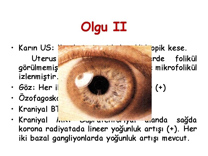 Olgu II • Karın US: Kc ekojenitesi kaba. Hidropik kese. Uterus boyutları N. Overlerde