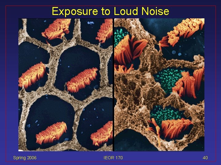 Exposure to Loud Noise Spring 2006 IEOR 170 40 