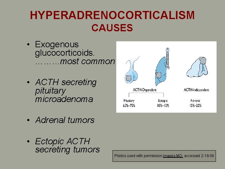 HYPERADRENOCORTICALISM CAUSES • Exogenous glucocorticoids. ……. . . most common • ACTH secreting pituitary HYPERADRENOCORTICALISM CAUSES • Exogenous glucocorticoids. ……. . . most common • ACTH secreting pituitary