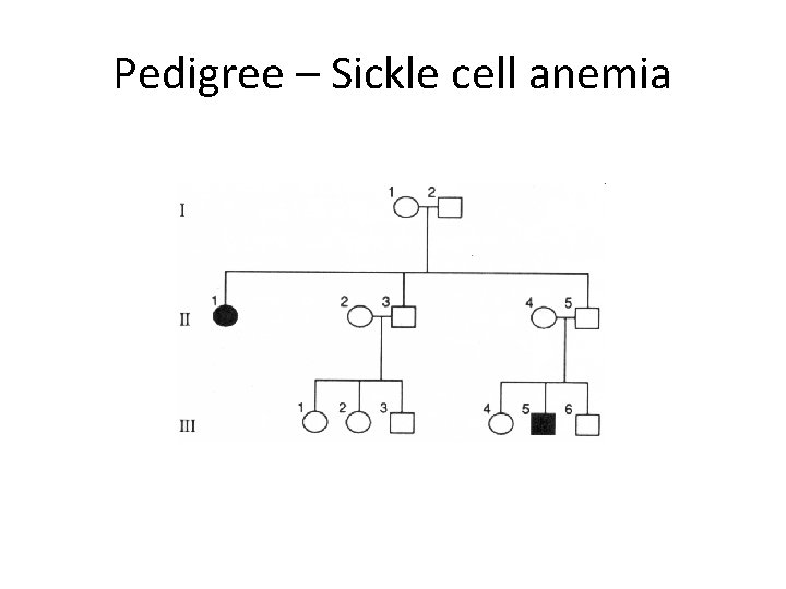 Pedigree – Sickle cell anemia 
