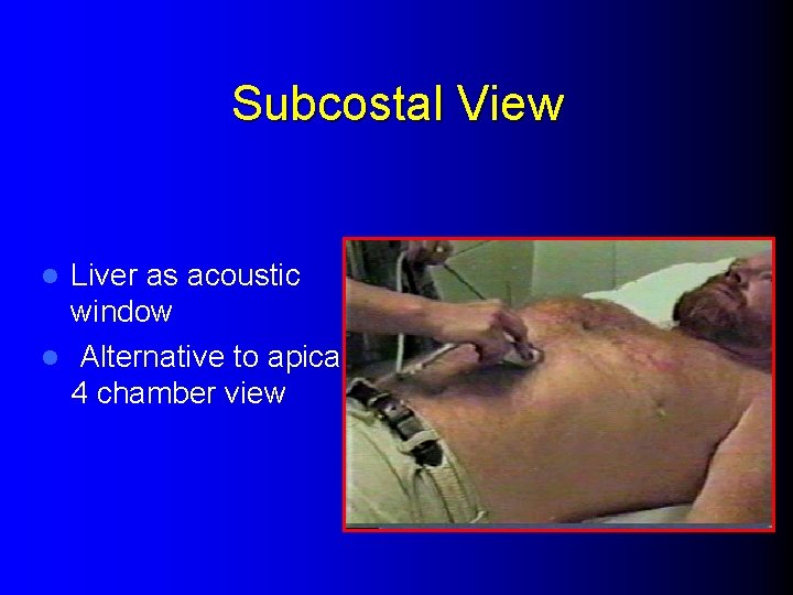 Subcostal View Liver as acoustic window l Alternative to apical 4 chamber view l